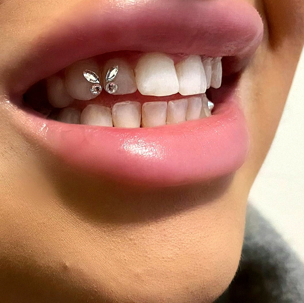 Close-up van een glimlach met tandjuweel – voorbeeld van langdurige hechting van een tooth gem
