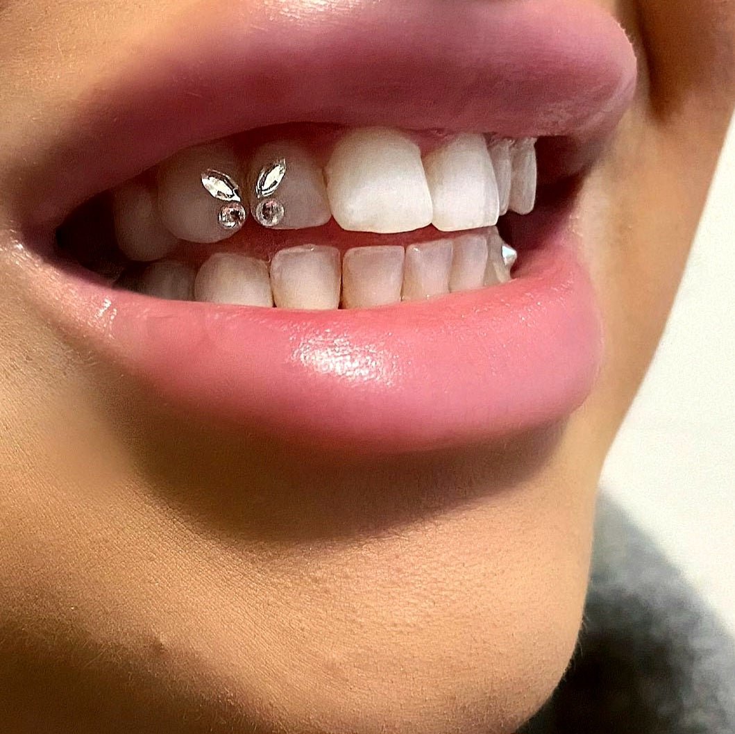 Hoe lang blijft een Tooth Gem zitten? - SelfGem