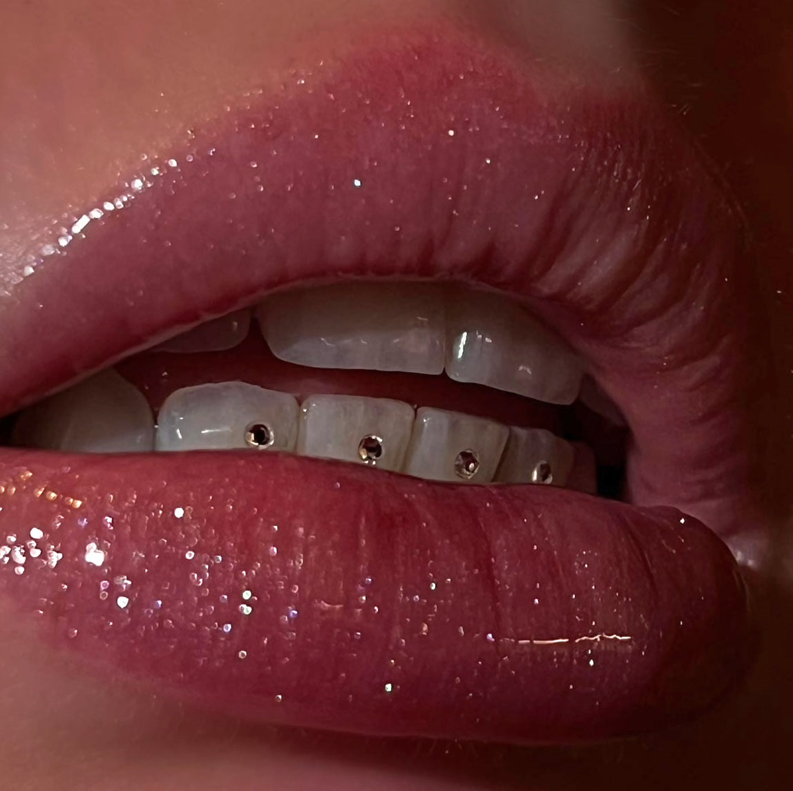  Diamanten Tooth Gems | Luxe Tooth Gem Kit | SelfGem