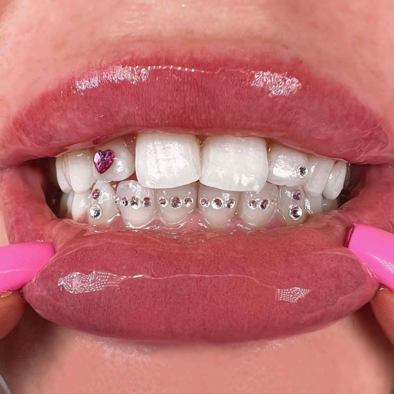  Paars Hart Tooth Gem Kit | Swarovski Tooth Gems Design | SelfGem