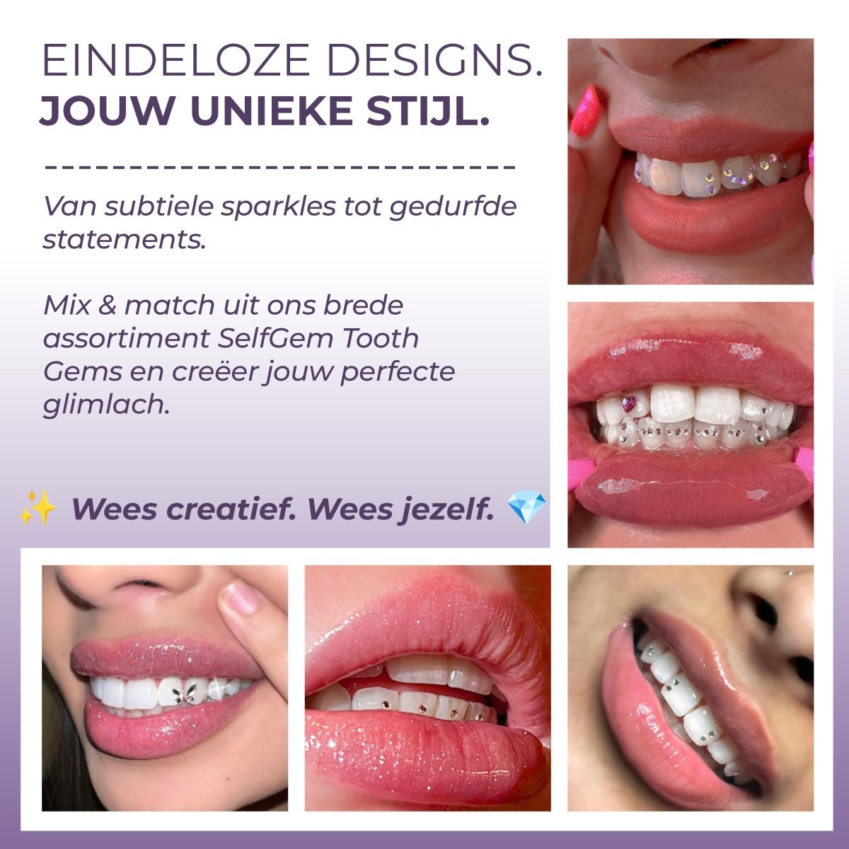 SelfGem™ DIY Tooth Gem Kit | Mixed Set (20 stuks) - SelfGem